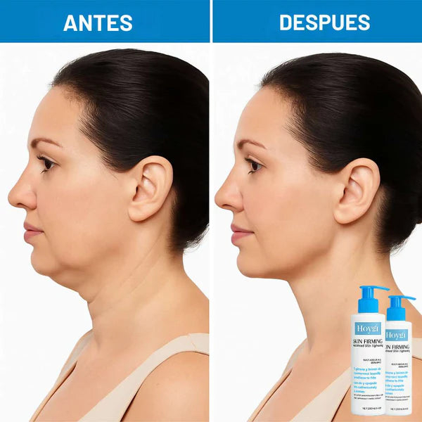 Nueva Crema Reafirmante Hoygi®: Recupera la firmeza y juventud de tu piel en solo 15 días