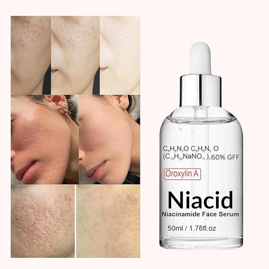 Nuevo NIACID®: Elimina manchas y cicatrices de acné en solo 4 semanas