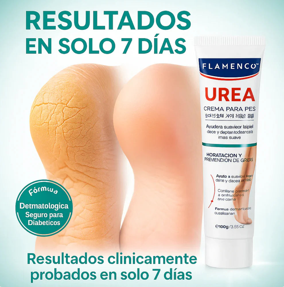 Nueva Crema de Urea 25% Flamenco®: Recupera la suavidad de tus pies y elimina los callos en solo 1 semana