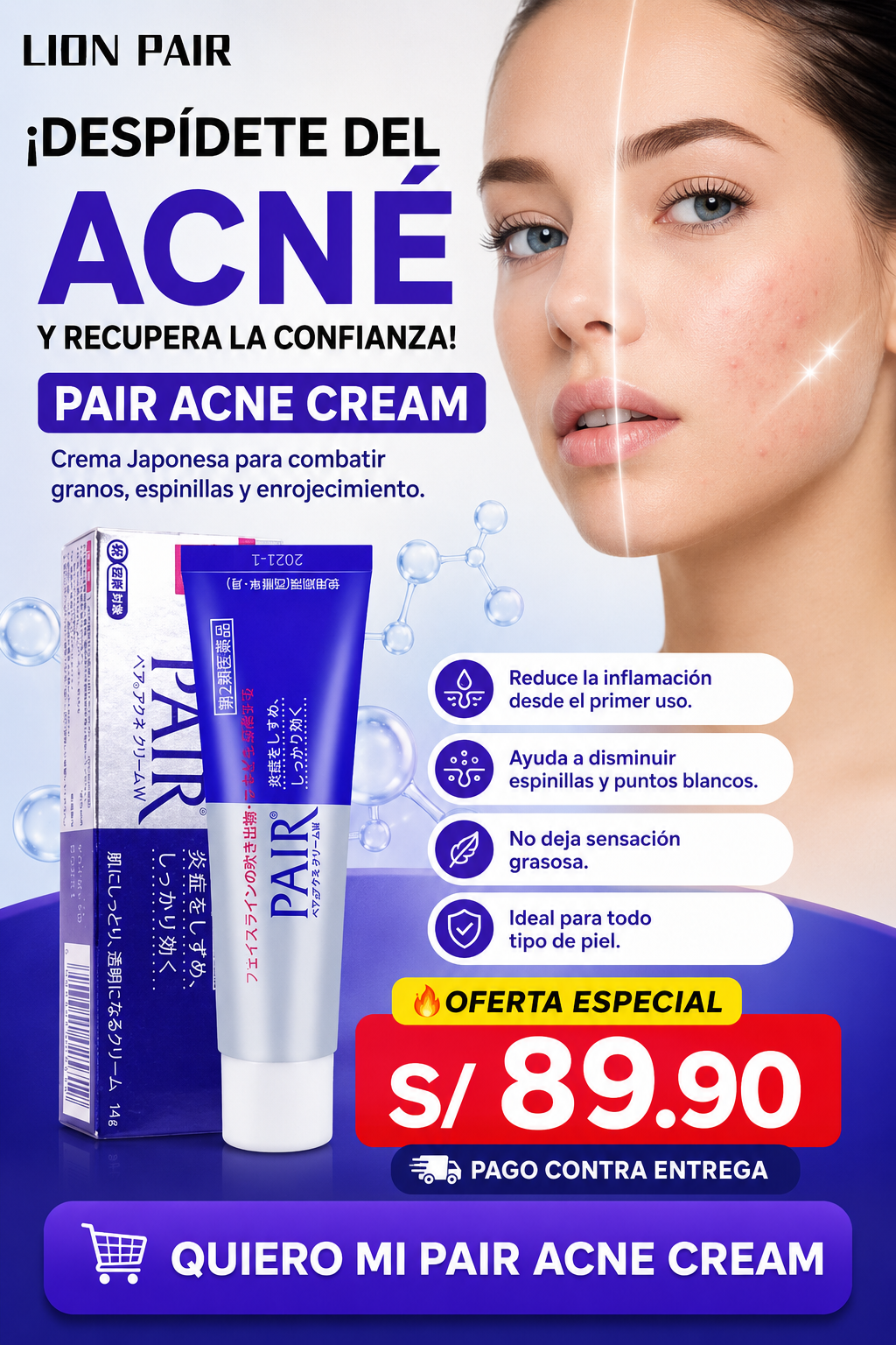 Nueva Crema Anti-Acné Pair®: Dile adiós a los granos y recupera una piel limpia en solo 2 semanas
