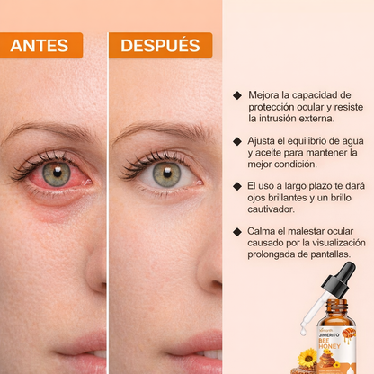 Nuevo Bee Honey ®: Recupera la claridad de tu mirada y elimina la carnosidad sin cirugías en solo 3 semanas