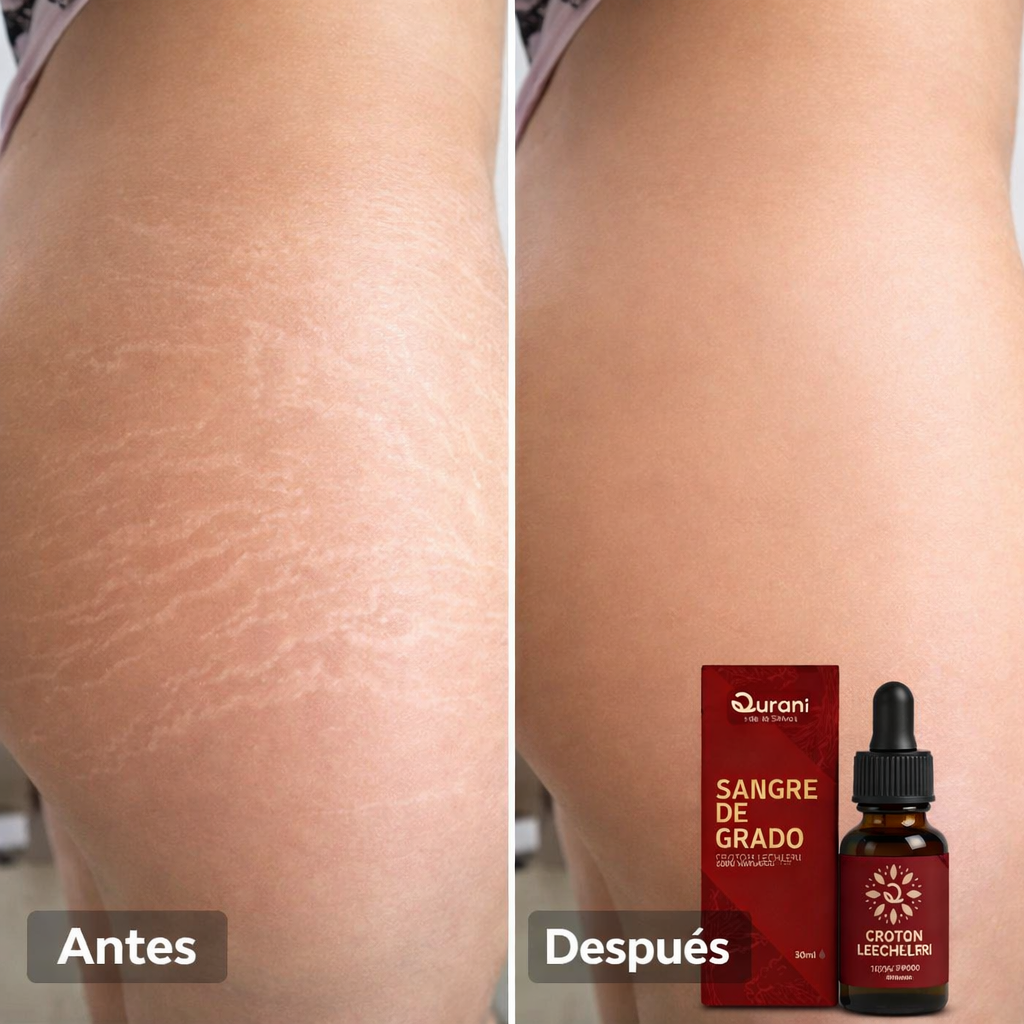 SERUM SANGRE DE GRADO® : Recupera una piel suave y sin estrías con el poder curativo del Amazonas