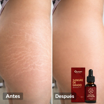 SERUM SANGRE DE GRADO® : Recupera una piel suave y sin estrías con el poder curativo del Amazonas