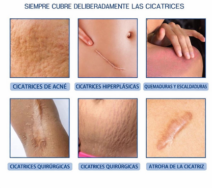 Nueva Crema Scar Removal®: Borra tus cicatrices y recupera la suavidad de tu piel en solo 14 días