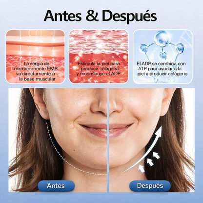 Nuevo V-Face®: Elimina la papada y perfila tu rostro mientras duermes en solo 2 semanas
