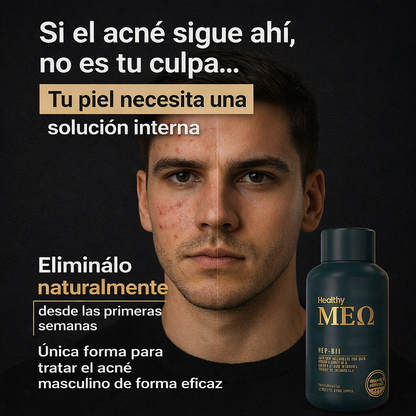 Nuevo Regulador Hormonal Antiacné®: Elimina los brotes y recupera tu confianza en solo 2 semanas.