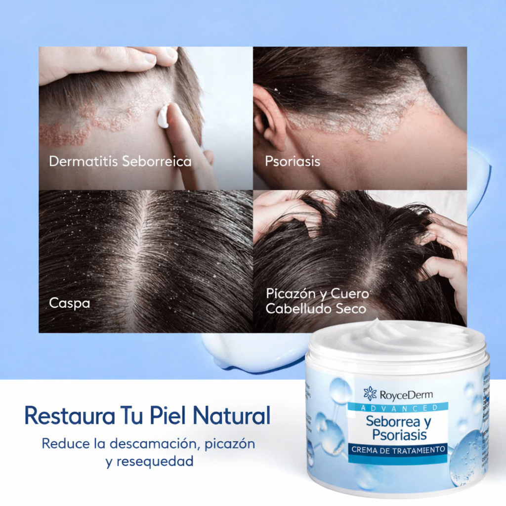 RoyceDerm®: Elimina la picazón y descamación en la primera semana