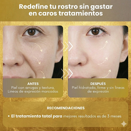 Hilos Tensores de Colágeno®: Recupera la firmeza y juventud de tu rostro sin agujas ni cirugías