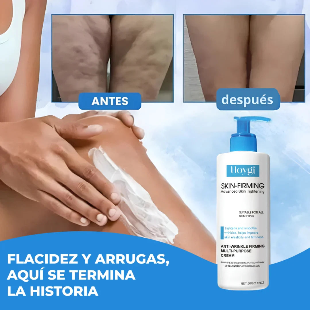Nueva Crema Reafirmante Hoygi®: Recupera la firmeza y juventud de tu piel en solo 15 días