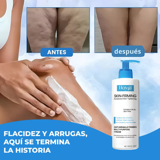 Nueva Crema Reafirmante Hoygi®: Recupera la firmeza y juventud de tu piel en solo 15 días