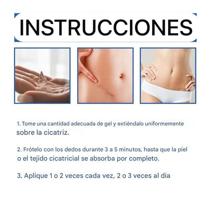 Nueva Crema Scar Removal®: Borra tus cicatrices y recupera la suavidad de tu piel en solo 14 días