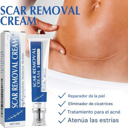 Nueva Crema Scar Removal®: Borra tus cicatrices y recupera la suavidad de tu piel en solo 14 días