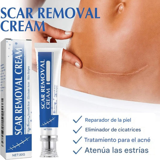 Nueva Crema Scar Removal®: Borra tus cicatrices y recupera la suavidad de tu piel en solo 14 días