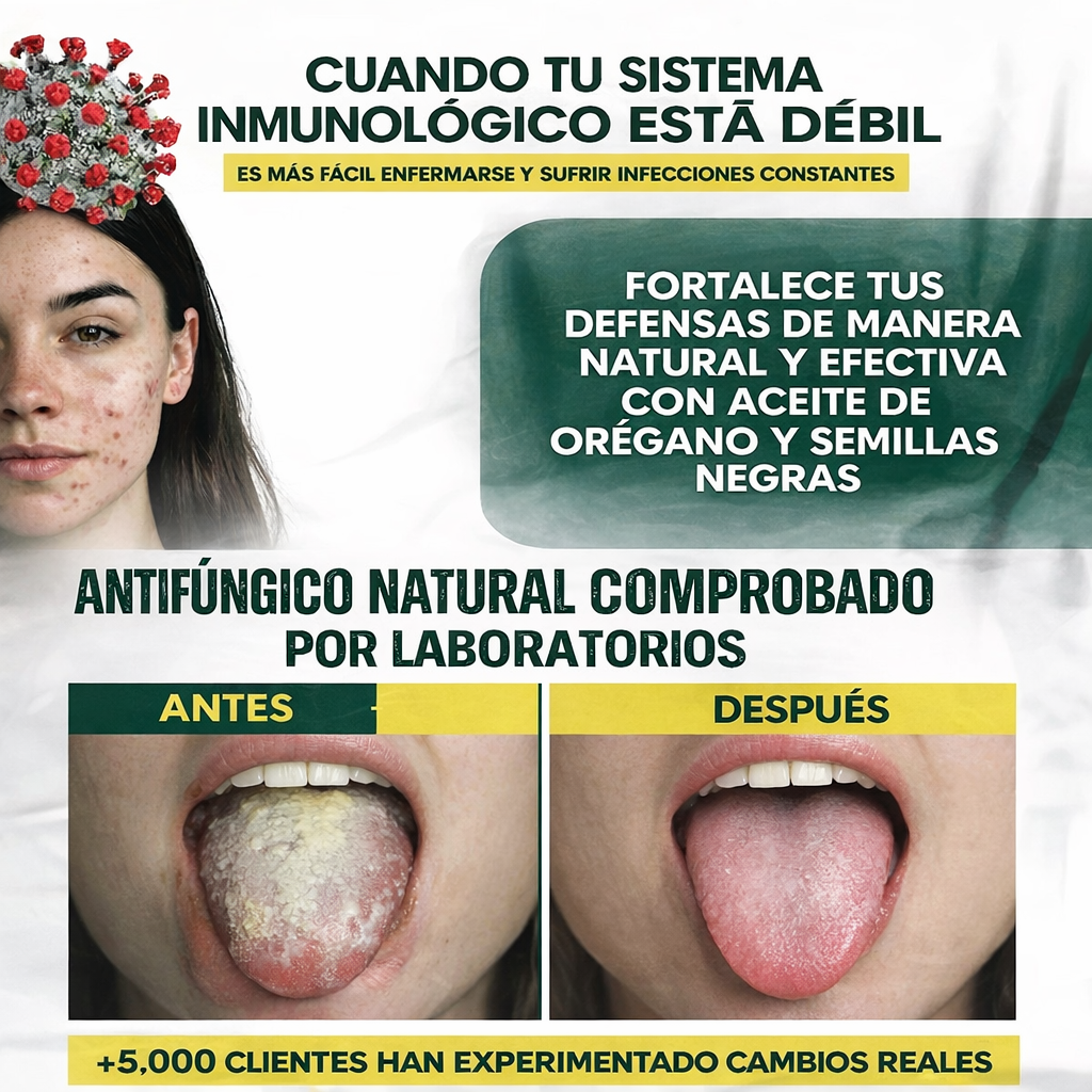 Nuevo Oregano Oil®: Elimina el hongo Cándida y recupera tu salud íntima en solo 2 semanas.