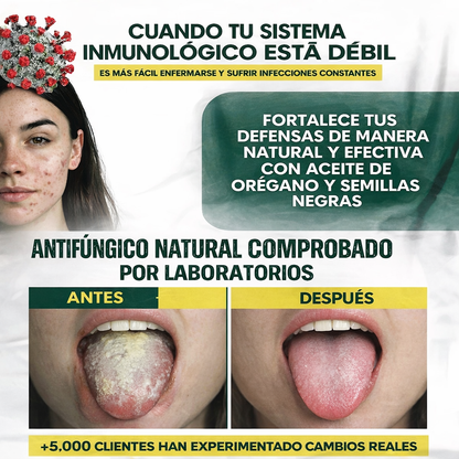 Nuevo Oregano Oil®: Elimina el hongo Cándida y recupera tu salud íntima en solo 2 semanas.