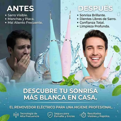 Limpiador Dental Ultrasónico®: Recupera una sonrisa blanca y libre de sarro en solo minutos