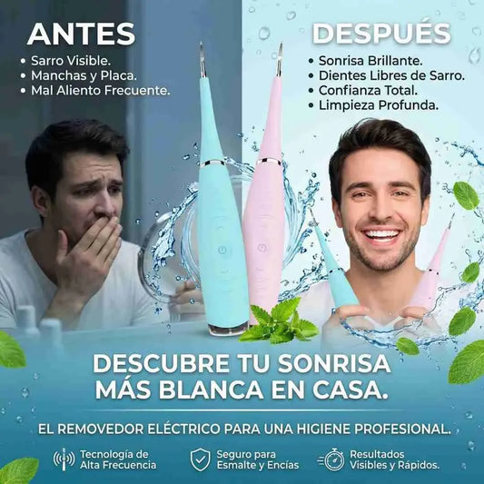 Limpiador Dental Ultrasónico®: Recupera una sonrisa blanca y libre de sarro en solo minutos