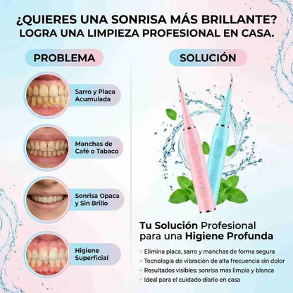 Limpiador Dental Ultrasónico®: Recupera una sonrisa blanca y libre de sarro en solo minutos